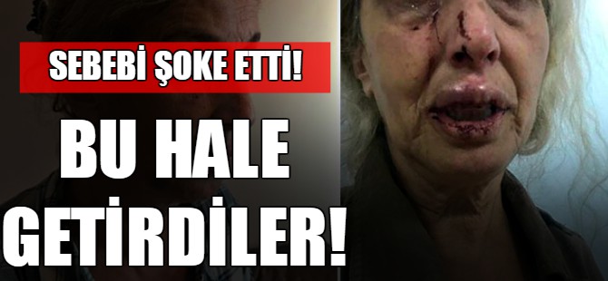 Bu hale getirdiler!
