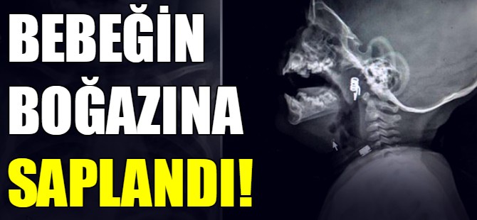 Bebeğin boğazına saplandı!