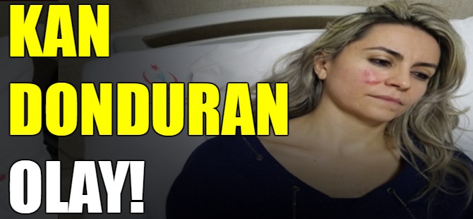 Kan donduran olay!