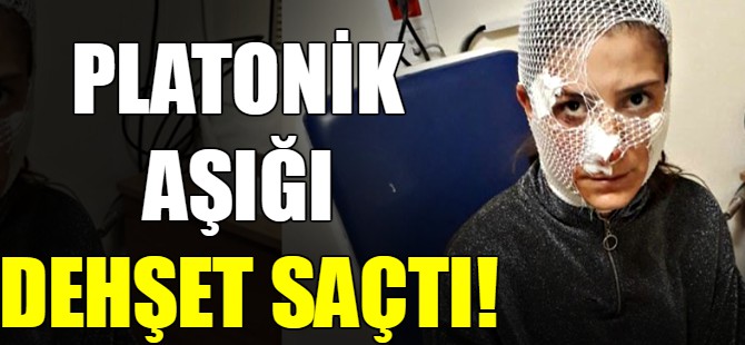 Platonik aşığı dehşet saçtı!