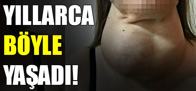 Yıllarca böyle yaşadı!