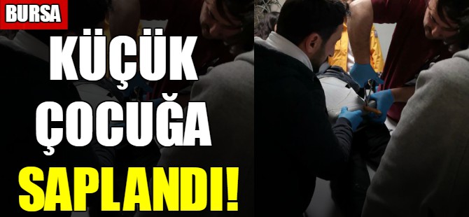 Küçük çocuğa saplandı!