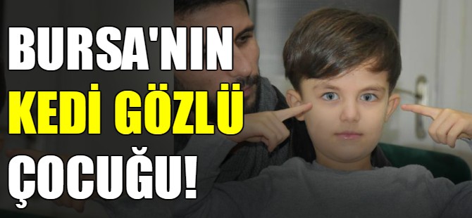 Bursa'nın kedi gözlü çocuğu!