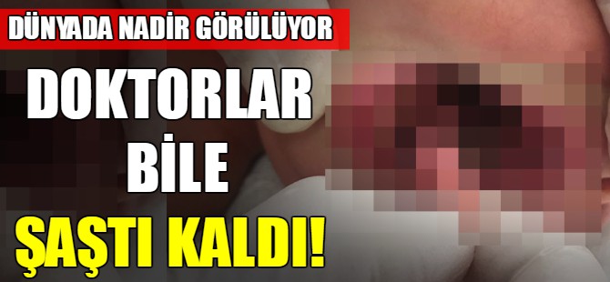Doktorlar bile şaştı kaldı!
