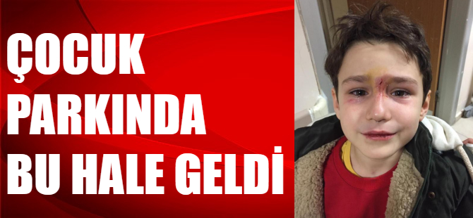 Bursa'daki çocuk parkı tehlike saçıyor