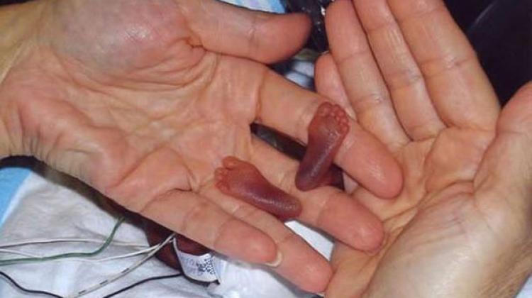 Parmak kız bakın şimdi nasıl?
