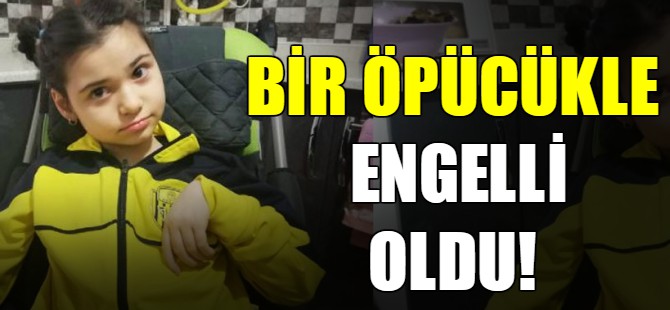 Bir öpücükle engelli oldu!