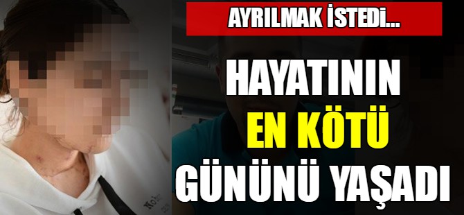Bitmek bilmeyen vahşet!