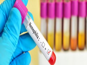 Hemofili hastalarına öneriler