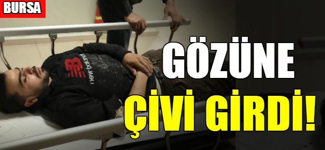 Gözüne çivi saplandı!