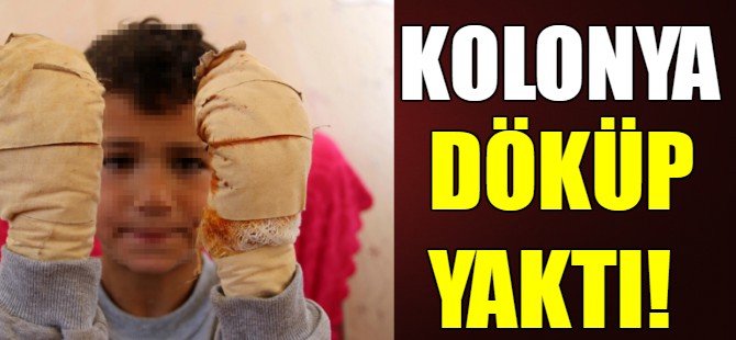 7 yaşındaki çocuğun ellerine kolonya döküp yaktı