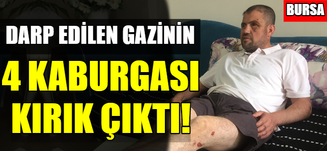 Gazinin 4 kaburgası kırık çıktı