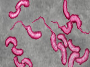 Sudan’da kolera salgını