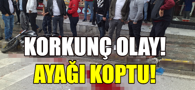 Motosikleti gencin ayağı koptu