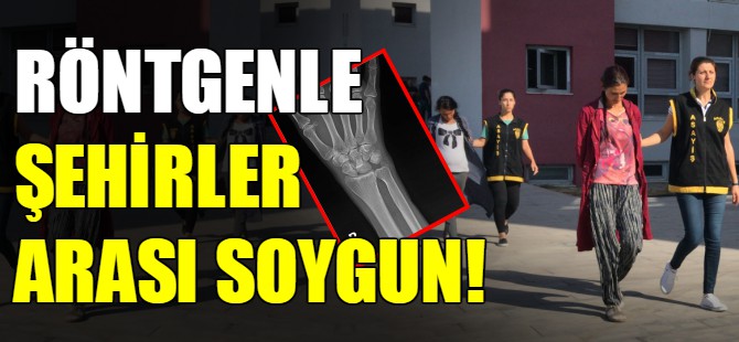Röntgenci soyguncular yok artık dedirtti