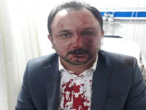 Bursa'da Sendika Başkanı'na saldırı