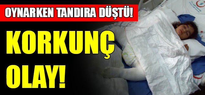 Küçük kız tandıra düştü