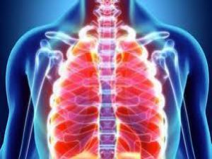Akciğer Kanserinin 4 öncül belirtisi