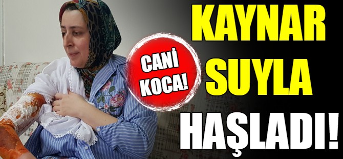 Eşini kaynar su ile haşlandı