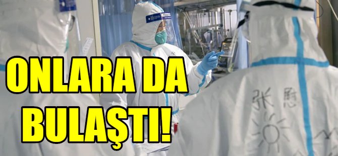 Koronavirüs doktor ve hemşirelere de bulaştı