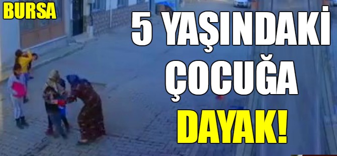 5 yaşındaki çocuğa feci dayak