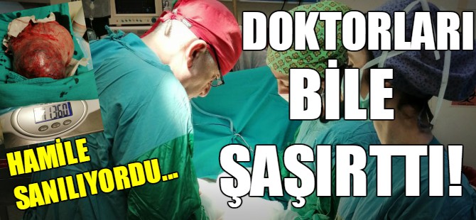 Hamile sanılıyordu! Tam 11 kilo...
