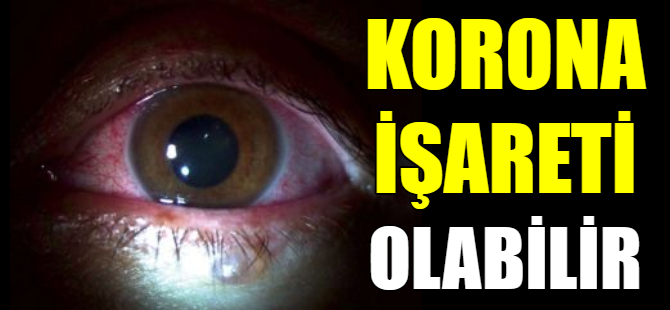 Göz kızarıklığı Korona işareti olabilir