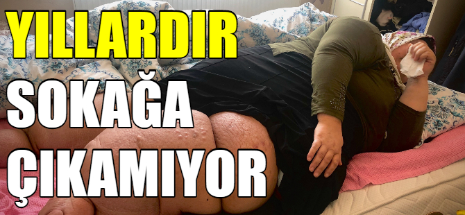 Bursalı kadın 5 yıldır sokağa çıkamıyor