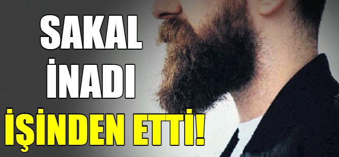 Sakal inadı işinden etti!