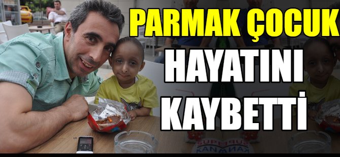 Parmak çocuk hayatını kaybetti