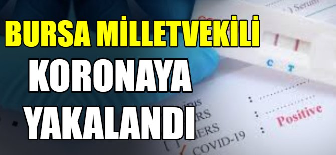 Bursa Milletvekili koronaya yakalandı
