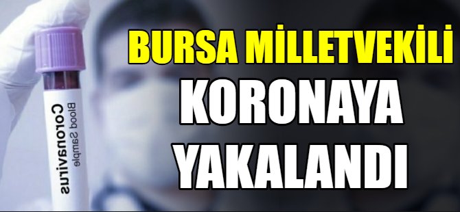 Bursa Milletvekili koronaya yakalandı!