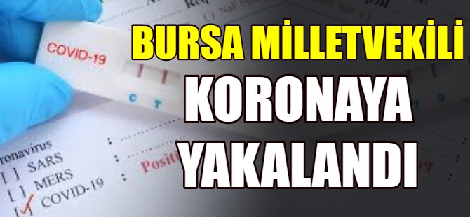 Bir vekil daha koronaya yakalandı