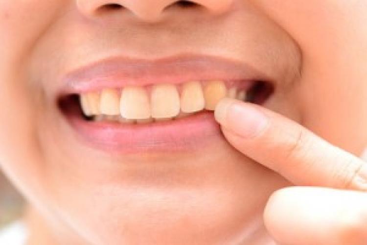 Diş çürükleri metabolizmayı etkiliyor