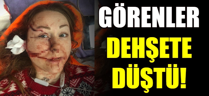 Görenler dehşete düştü!