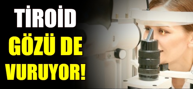 Tiroid gözü de vuruyor!