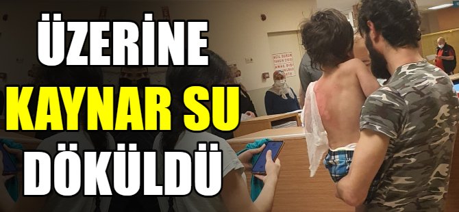 Üzerine kaynar su döküldü