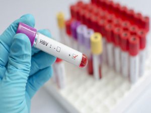 Hepatitli olup farkında olmayabilirsiniz