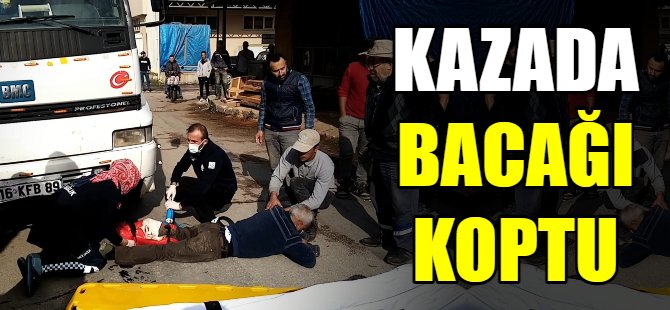 Kazada bacağı kopyu