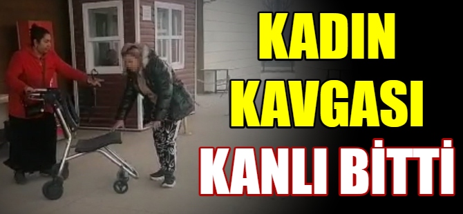 Kadınların kavgası kanlı bitti