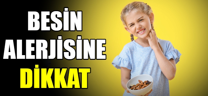 Besin alerjisi iki kat arttı