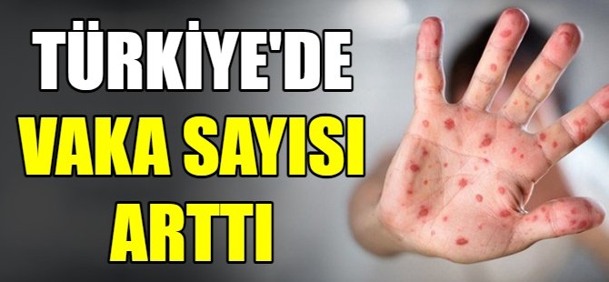 Türkiye'de vaka sayısı arttı