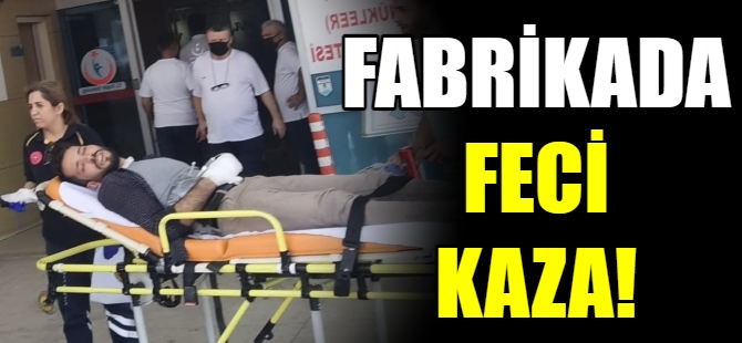 Fabrikada feci kaza