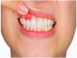 Diş sağlığını etkileyen faktörler