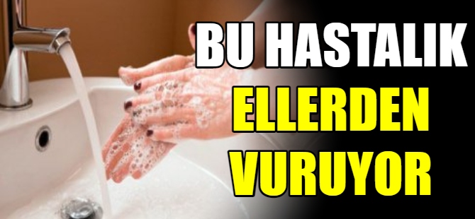 Bu hastalık en çok ellerden vuruyor