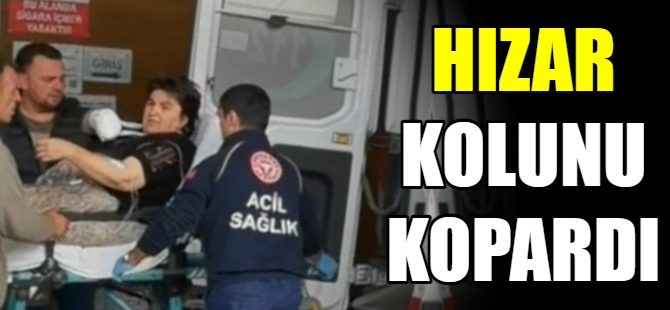 Hızarın üzerine düşen kadının kolu koptu