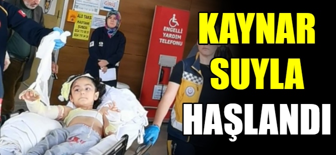 Kaynar suyla haşlandı