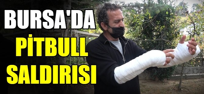 Bursa'da pitbull saldırısı