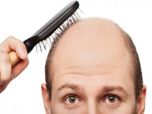 Saç dökülmesine tetikleyen sebepler