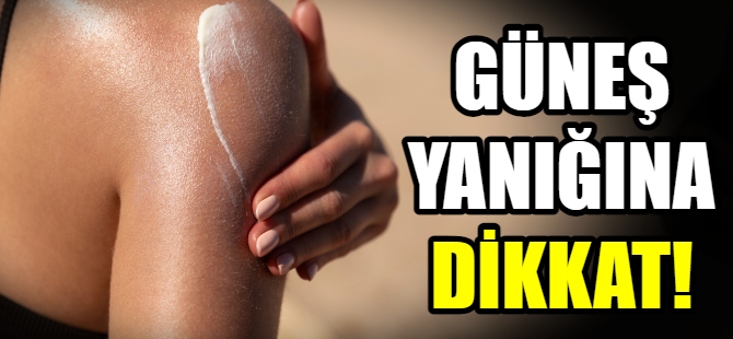 Güneş yanığına karşı 10 öneri